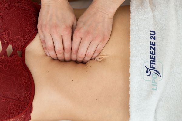 diastasis recti treatment Bridgwater