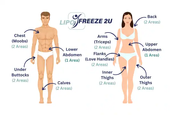 Areas you can have fat freezing treatment Bridgwater