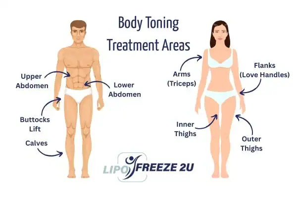 Graphic showing where you can have Body toning Treatment Bridgwater on your body
