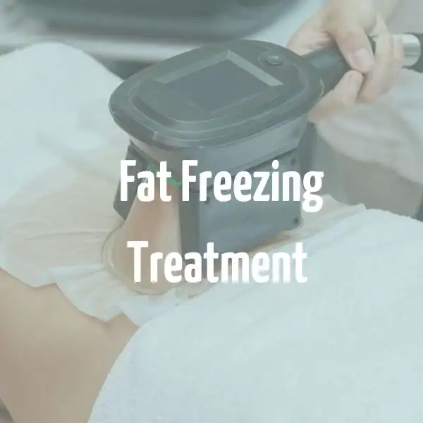 fat freezing treatment Bridgwater